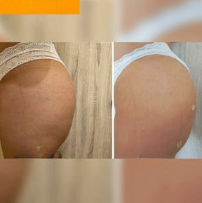 Crema Moldeadora Buttock Shape - Los glúteos de ensueño - Envío gratis solo hoy