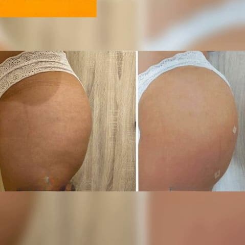 Crema Moldeadora Buttock Shape - Los glúteos de ensueño - Envío gratis solo hoy