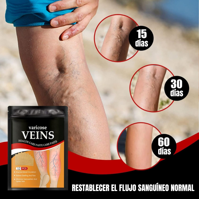 Poderoso Anti Varices Veins Gold – Tratamiento completo + Envío Gratis para toda Colombia