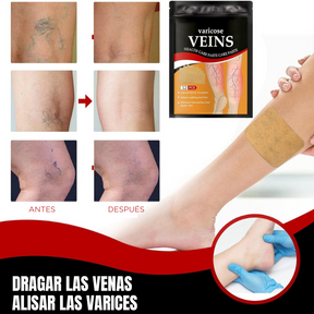 Poderoso Anti Varices Veins Gold – Tratamiento completo + Envío Gratis para toda Colombia